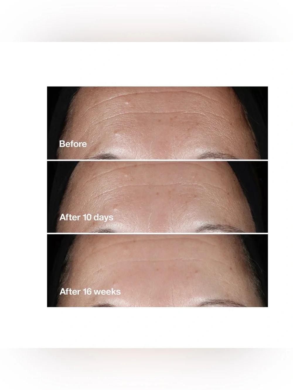 Clinique Smart Clinical Repair Wrinkle Correcting Serum